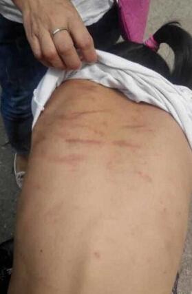 9歲女童常遭親媽拳打腳踢竹棍抽稱“仍愛媽媽”