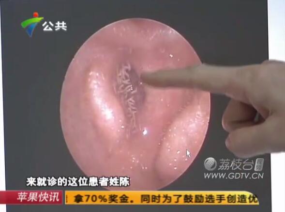 �@�������Ӷ���(n��i)�L(zh��ng)�M��ɫ���x��˺ҧ����ʹ��������