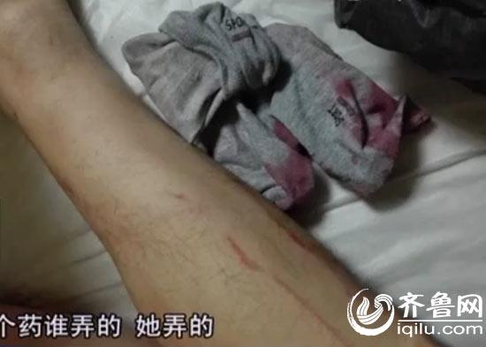 小伙手指斷裂身中“百草枯” 或因前女友報復(fù)