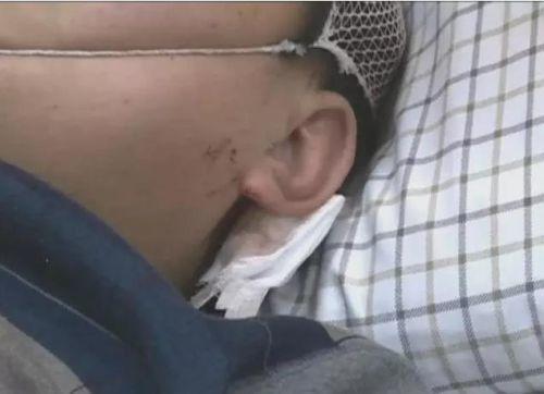 �����һ�𱻴�ģ�߀��������߅�����ϵ��ܴ������(j��ng)�^�t(y��)�������Д࣬�ܴ�����~��Ƥ��ܛ�M�����[Û��һֱ���ڻ��Ԡ�B(t��i)��Ŀǰ߀�]�ж��^Σ�U�ڡ�